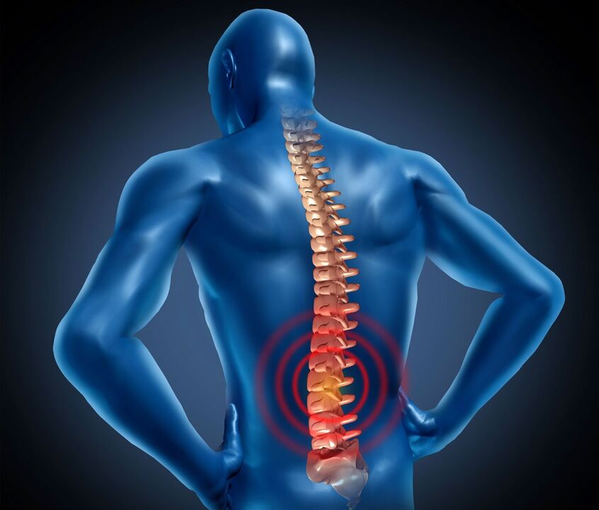 Ledvena osteohondroza