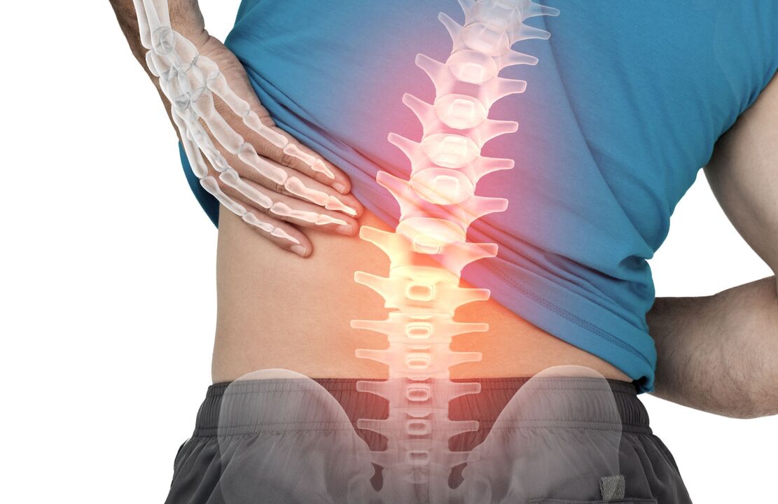 Nevarnost ostehondroze ledve