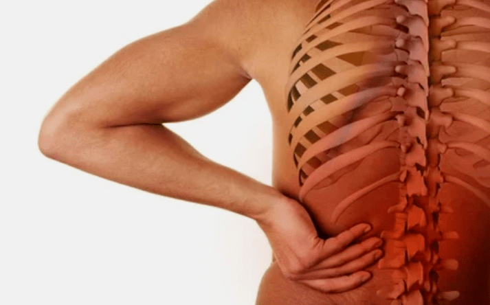 Vzroki za osteohondrozo ledve