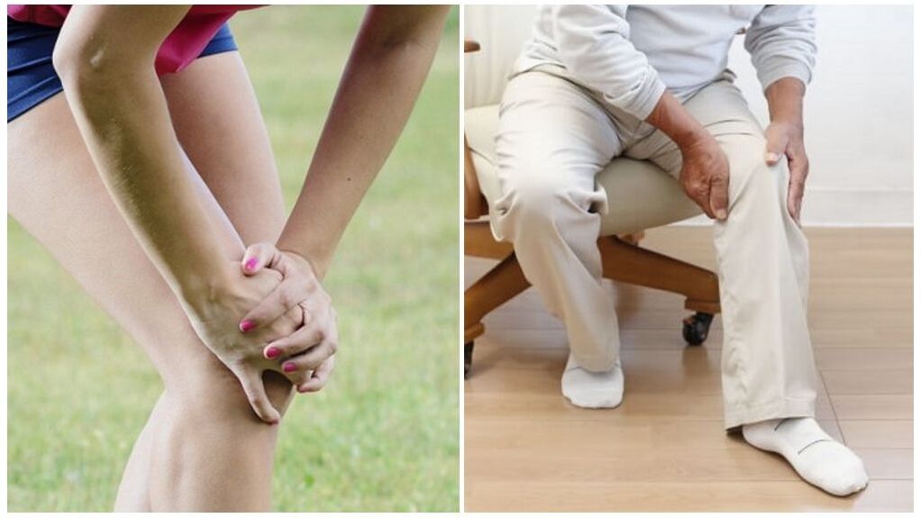 Poškodbe in starostne spremembe so glavni vzroki artroze kolenskega sklepa